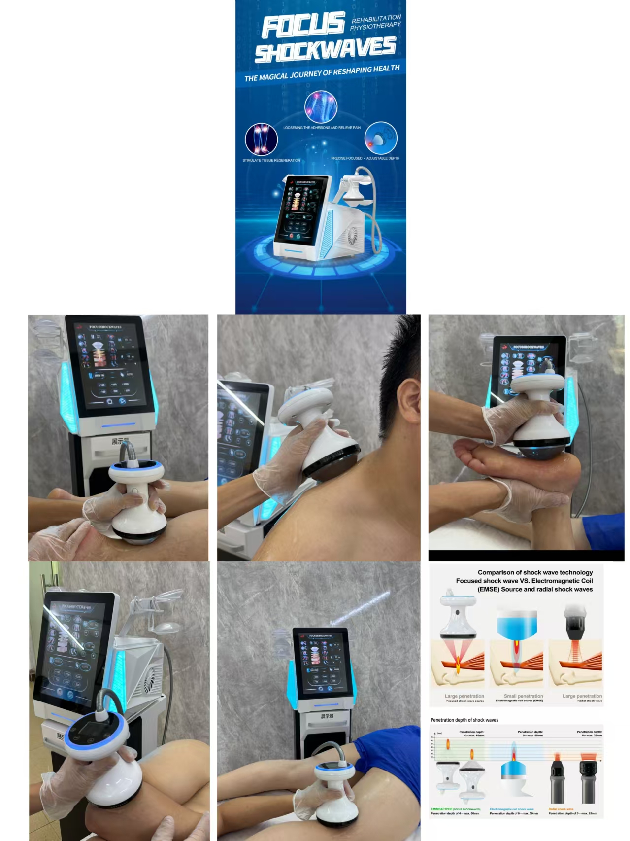 อุปกรณ์บำบัดด้วยคลื่นกระแทกระด - Japanese Tech Accessories บทวิจารณ์และราคา